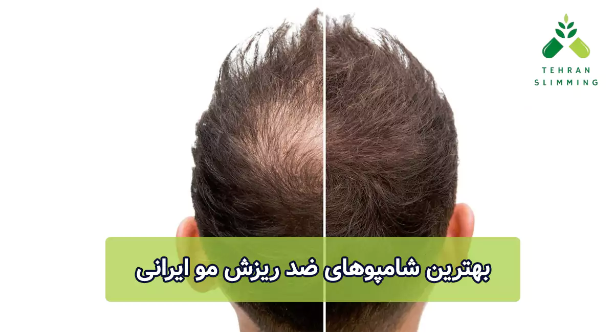 بهترین شامپوهای ضد ریزش مو ایرانی