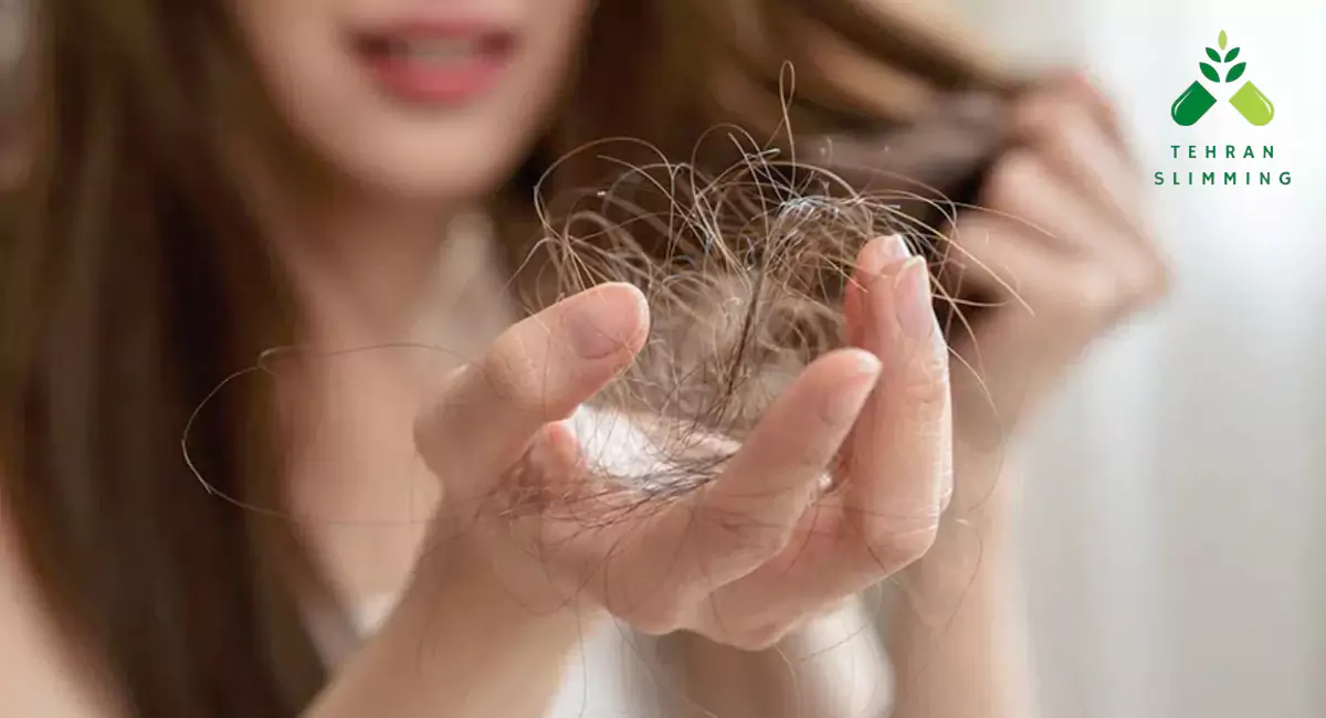 علت ریزش مو چیست؟