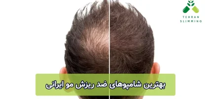 بهترین شامپوهای ضد ریزش مو ایرانی